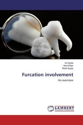 Gupta / Khan |  Furcation involvement | Buch |  Sack Fachmedien