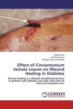 Soni / Jain / Choudhary |  Effect of Cinnamomum tamala Leaves on Wound Healing in Diabetes | Buch |  Sack Fachmedien