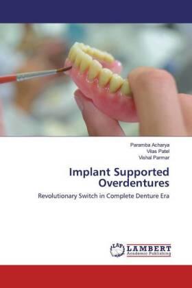 Acharya / Patel / Parmar |  Implant Supported Overdentures | Buch |  Sack Fachmedien