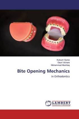 Guroo / Vichare / Mushtaq |  Bite Opening Mechanics | Buch |  Sack Fachmedien