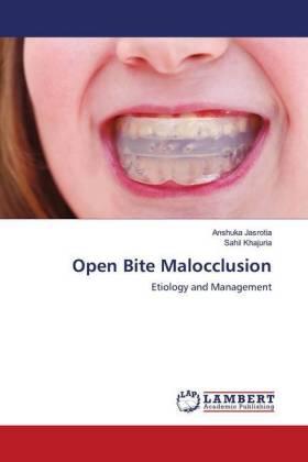 Jasrotia / Khajuria | Open Bite Malocclusion | Buch | 978-620-2-66882-8 | sack.de