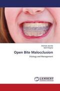 Jasrotia / Khajuria |  Open Bite Malocclusion | Buch |  Sack Fachmedien