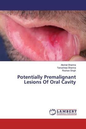 Sharma / Singh | Potentially Premalignant Lesions Of Oral Cavity | Buch | 978-620-2-66924-5 | www.sack.de