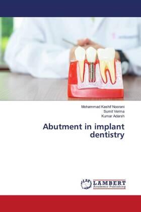 Noorani / Verma / Adarsh |  Abutment in implant dentistry | Buch |  Sack Fachmedien