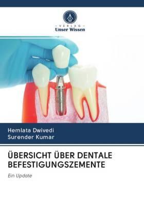Dwivedi / Kumar |  ÜBERSICHT ÜBER DENTALE BEFESTIGUNGSZEMENTE | Buch |  Sack Fachmedien