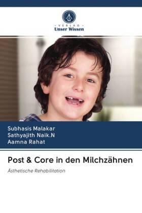 Malakar / Naik. N / Rahat |  Post & Core in den Milchzähnen | Buch |  Sack Fachmedien