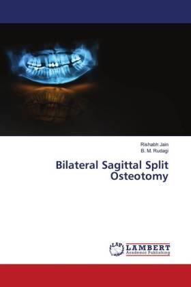 Jain / Rudagi |  Bilateral Sagittal Split Osteotomy | Buch |  Sack Fachmedien