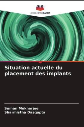 Mukherjee / Dasgupta |  Situation actuelle du placement des implants | Buch |  Sack Fachmedien