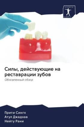 Singh / Dzhadhaw / Rani |  Sily, dejstwuüschie na restawracii zubow | Buch |  Sack Fachmedien