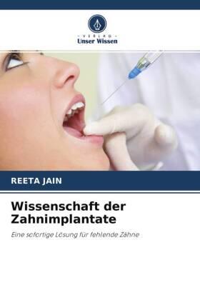 Jain | Wissenschaft der Zahnimplantate | Buch | 978-620-295440-2 | sack.de