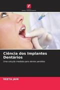 Jain |  Ciência dos Implantes Dentários | Buch |  Sack Fachmedien