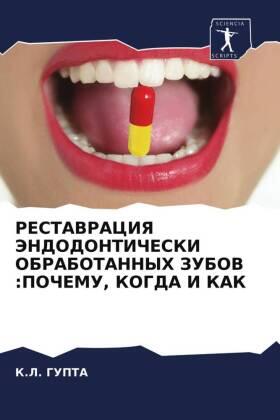 Gupta |  RESTAVRACIYa JeNDODONTIChESKI OBRABOTANNYH ZUBOV :POChEMU, KOGDA I KAK | Buch |  Sack Fachmedien