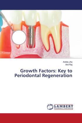 Jha / Raj |  Growth Factors: Key to Periodontal Regeneration | Buch |  Sack Fachmedien