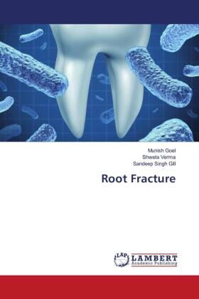 Goel / Verma / Gill |  Root Fracture | Buch |  Sack Fachmedien