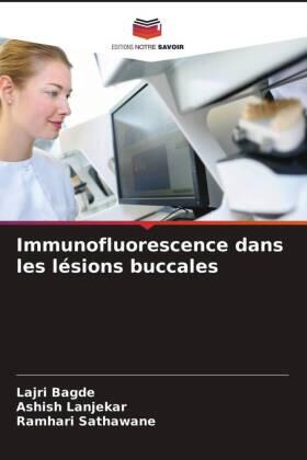 Bagde / Lanjekar / Sathawane | Immunofluorescence dans les lésions buccales | Buch | 978-620-3-24261-4 | www.sack.de