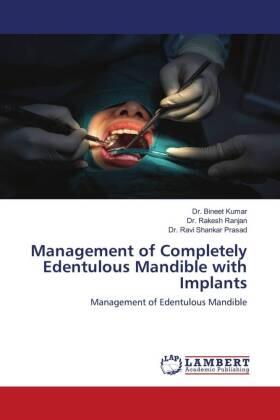 Kumar / Ranjan / Prasad |  Management of Completely Edentulous Mandible with Implants | Buch |  Sack Fachmedien