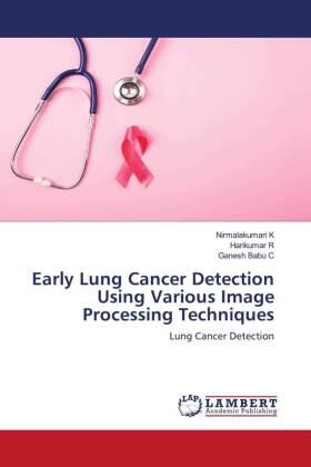 K / R / C |  Early Lung Cancer Detection Using Various Image Processing Techniques | Buch |  Sack Fachmedien