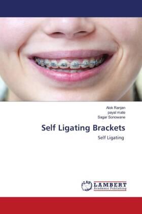 Ranjan / Mate / Sonowane |  Self Ligating Brackets | Buch |  Sack Fachmedien