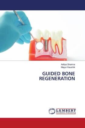 Sharma / Kaushik |  GUIDED BONE REGENERATION | Buch |  Sack Fachmedien