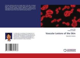 Riaz / Quamar |  Vascular Lesions of the Skin | Buch |  Sack Fachmedien