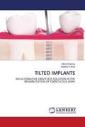 Sharma / Bhat |  Tilted Implants | Buch |  Sack Fachmedien