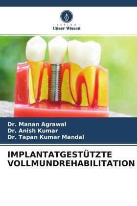 Agrawal / Kumar / Mandal |  IMPLANTATGESTÜTZTE VOLLMUNDREHABILITATION | Buch |  Sack Fachmedien
