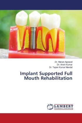 Agrawal / Kumar / Mandal |  Implant Supported Full Mouth Rehabilitation | Buch |  Sack Fachmedien