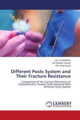 Kumari / Gupta |  Different Posts System and Their Fracture Resistance | Buch |  Sack Fachmedien