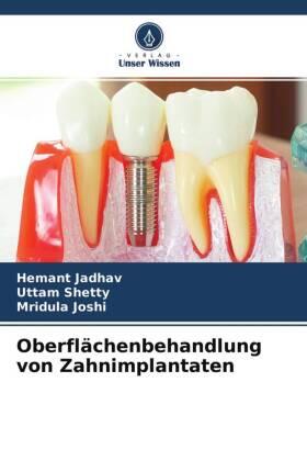 Jadhav / Shetty / Joshi |  Oberflächenbehandlung von Zahnimplantaten | Buch |  Sack Fachmedien