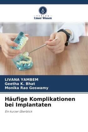 Yambem / Bhat / Rao Goswamy |  Häufige Komplikationen bei Implantaten | Buch |  Sack Fachmedien