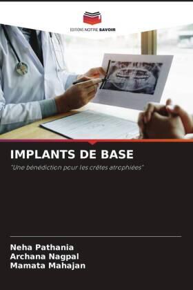 Pathania / Nagpal / Mahajan |  IMPLANTS DE BASE | Buch |  Sack Fachmedien