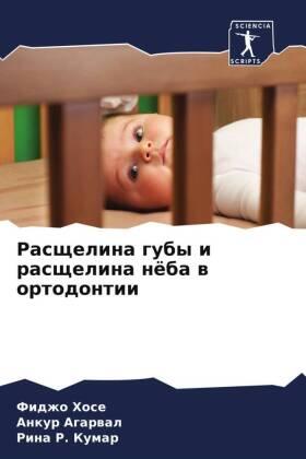 Hose / Agarwal / Kumar |  Rasschelina guby i rasschelina nöba w ortodontii | Buch |  Sack Fachmedien
