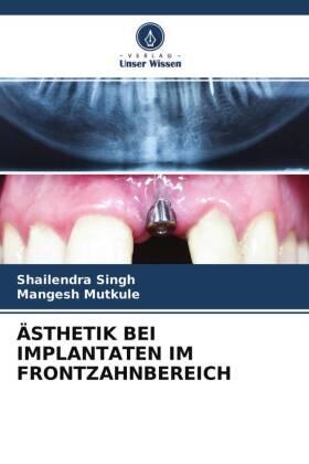 Singh / Mutkule |  ÄSTHETIK BEI IMPLANTATEN IM FRONTZAHNBEREICH | Buch |  Sack Fachmedien