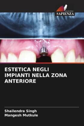 Singh / Mutkule |  ESTETICA NEGLI IMPIANTI NELLA ZONA ANTERIORE | Buch |  Sack Fachmedien