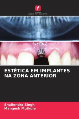 Singh / Mutkule |  ESTÉTICA EM IMPLANTES NA ZONA ANTERIOR | Buch |  Sack Fachmedien