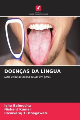 Balmuchu / Kumar / Bhagawati |  DOENÇAS DA LÍNGUA | Buch |  Sack Fachmedien