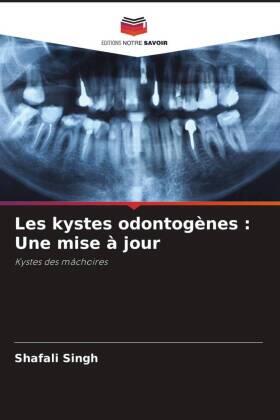 Singh |  Les kystes odontogènes : Une mise à jour | Buch |  Sack Fachmedien