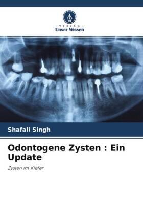 Singh |  Odontogene Zysten : Ein Update | Buch |  Sack Fachmedien