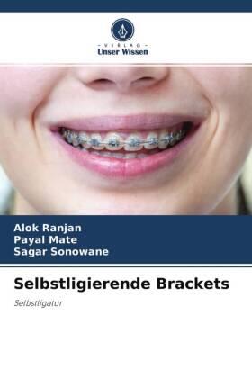 Ranjan / Mate / Sonowane |  Selbstligierende Brackets | Buch |  Sack Fachmedien