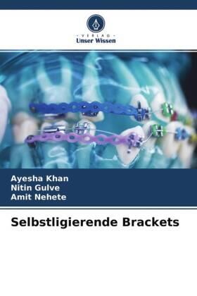 Khan / Gulve / Nehete |  Selbstligierende Brackets | Buch |  Sack Fachmedien