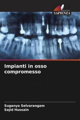 Selvarangam / Hussain |  Impianti in osso compromesso | Buch |  Sack Fachmedien