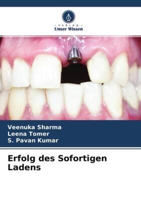Sharma / Tomer / Kumar |  Erfolg des Sofortigen Ladens | Buch |  Sack Fachmedien