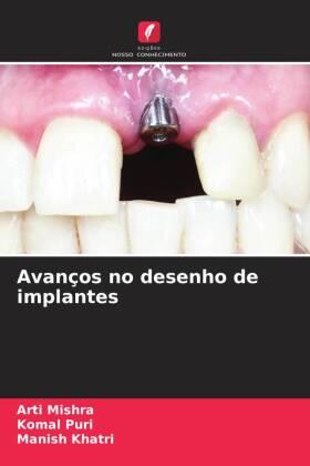 Mishra / Puri / Khatri |  Avanços no desenho de implantes | Buch |  Sack Fachmedien