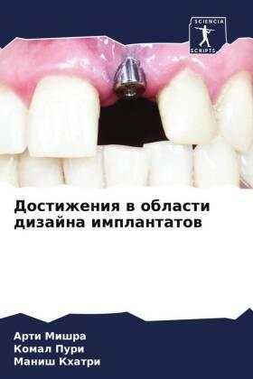 Mishra / Puri / Khatri |  Dostizheniq w oblasti dizajna implantatow | Buch |  Sack Fachmedien