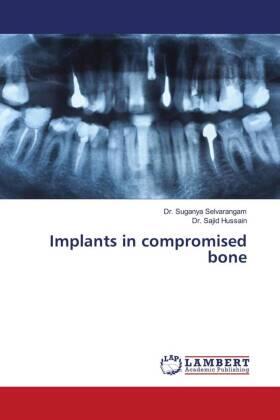 Selvarangam / Hussain |  Implants in compromised bone | Buch |  Sack Fachmedien