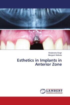 Singh / Mutkule |  Esthetics in Implants in Anterior Zone | Buch |  Sack Fachmedien