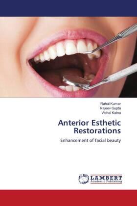 Kumar / Gupta / Katna |  Anterior Esthetic Restorations | Buch |  Sack Fachmedien