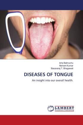Balmuchu / Kumar / Bhagawati |  DISEASES OF TONGUE | Buch |  Sack Fachmedien