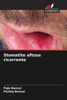Bansal |  Stomatite aftosa ricorrente | Buch |  Sack Fachmedien
