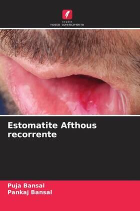 Bansal |  Estomatite Afthous recorrente | Buch |  Sack Fachmedien